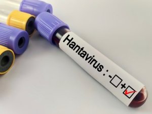Hantavirüs Bir Salgına Dönüşür mü?