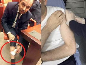 Bacağından ısırılan AK Partili vekil öyle bir fotoğraf paylaştı ki!