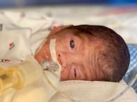 648 Gram Doğan Umut Bebek Hayata Tutunmayı Başardı
