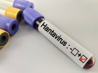 Hantavirüs Bir Salgına Dönüşür mü?