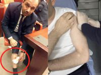 Bacağından ısırılan AK Partili vekil öyle bir fotoğraf paylaştı ki!